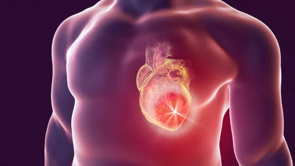 Arythmie cardiaque